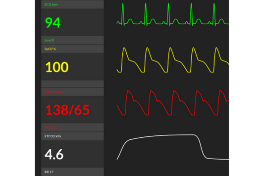Free Training Tool: Remote-Controlled Training Monitor