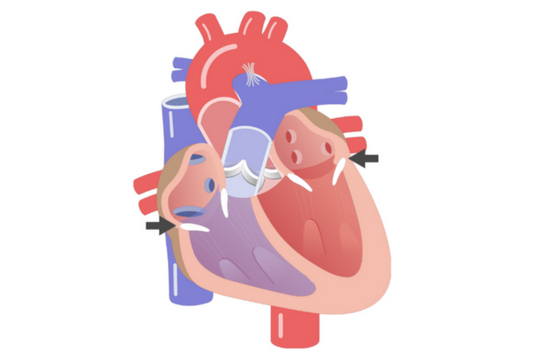 3D heart picture