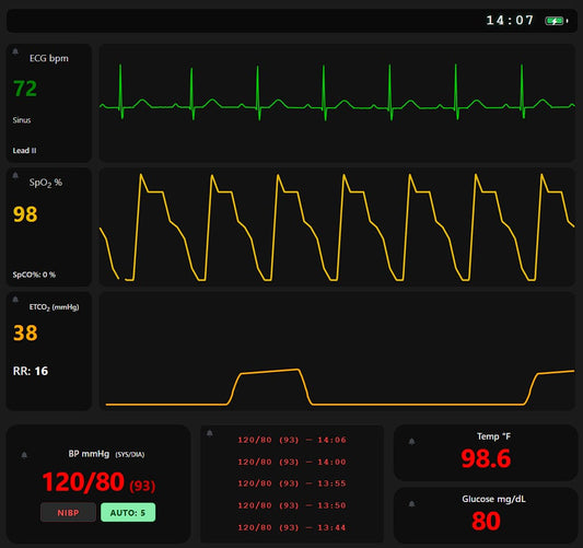 Vital Signs Simulator: Free Remote-Controlled EMS Training Tool